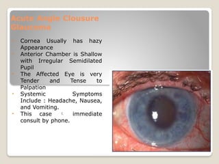 Ocular_Emergency_and_....Management[1].pptx