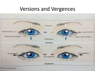 Versions and Vergences
 
