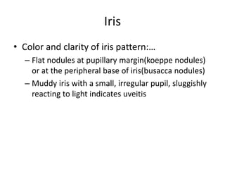 Iris
• Color and clarity of iris pattern:…
– Flat nodules at pupillary margin(koeppe nodules)
or at the peripheral base of iris(busacca nodules)
– Muddy iris with a small, irregular pupil, sluggishly
reacting to light indicates uveitis
 