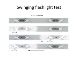 Swinging flashlight test
 