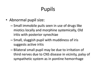 Pupils
• Abnormal pupil size:
– Small immobile puils seen in use of drugs like
miotics locally and morphine systemically, Old
iritis with posterior synechiae
– Small, sluggish pupil with muddiness of iris
suggests active iritis
– Bilateral small pupil may be due to irritation of
third nerves due to CNS disease in vicinity, palsy of
sympathetic system as in pontine hemorrhage
 
