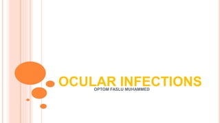 OCULAR INFECTIONSOPTOM FASLU MUHAMMED
 
