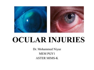 OCULAR INJURIES
Dr. Mohammed Niyaz
MEM PGY1
ASTER MIMS-K
 