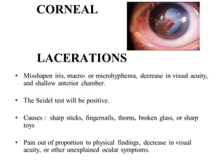 CORNEAL
LACERATIONS
• Misshapen iris, macro- or microhyphema, decrease in visual acuity,
and shallow anterior chamber.
• The Seidel test will be positive.
• Causes : sharp sticks, fingernails, thorns, broken glass, or sharp
toys
• Pain out of proportion to physical findings, decrease in visual
acuity, or other unexplained ocular symptoms.
 