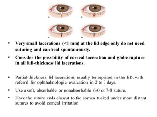 • Very small lacerations (<1 mm) at the lid edge only do not need
suturing and can heal spontaneously.
• Consider the possibility of corneal laceration and globe rupture
in all full-thickness lid lacerations.
• Partial-thickness lid lacerations usually be repaired in the ED, with
referral for ophthalmologic evaluation in 2 to 3 days.
• Use a soft, absorbable or nonabsorbable 6-0 or 7-0 suture.
• Have the suture ends closest to the cornea tucked under more distant
sutures to avoid corneal irritation
 