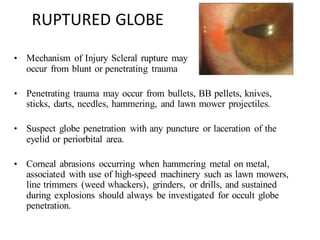RUPTURED GLOBE
• Mechanism of Injury Scleral rupture may
occur from blunt or penetrating trauma
• Penetrating trauma may occur from bullets, BB pellets, knives,
sticks, darts, needles, hammering, and lawn mower projectiles.
• Suspect globe penetration with any puncture or laceration of the
eyelid or periorbital area.
• Corneal abrasions occurring when hammering metal on metal,
associated with use of high-speed machinery such as lawn mowers,
line trimmers (weed whackers), grinders, or drills, and sustained
during explosions should always be investigated for occult globe
penetration.
 