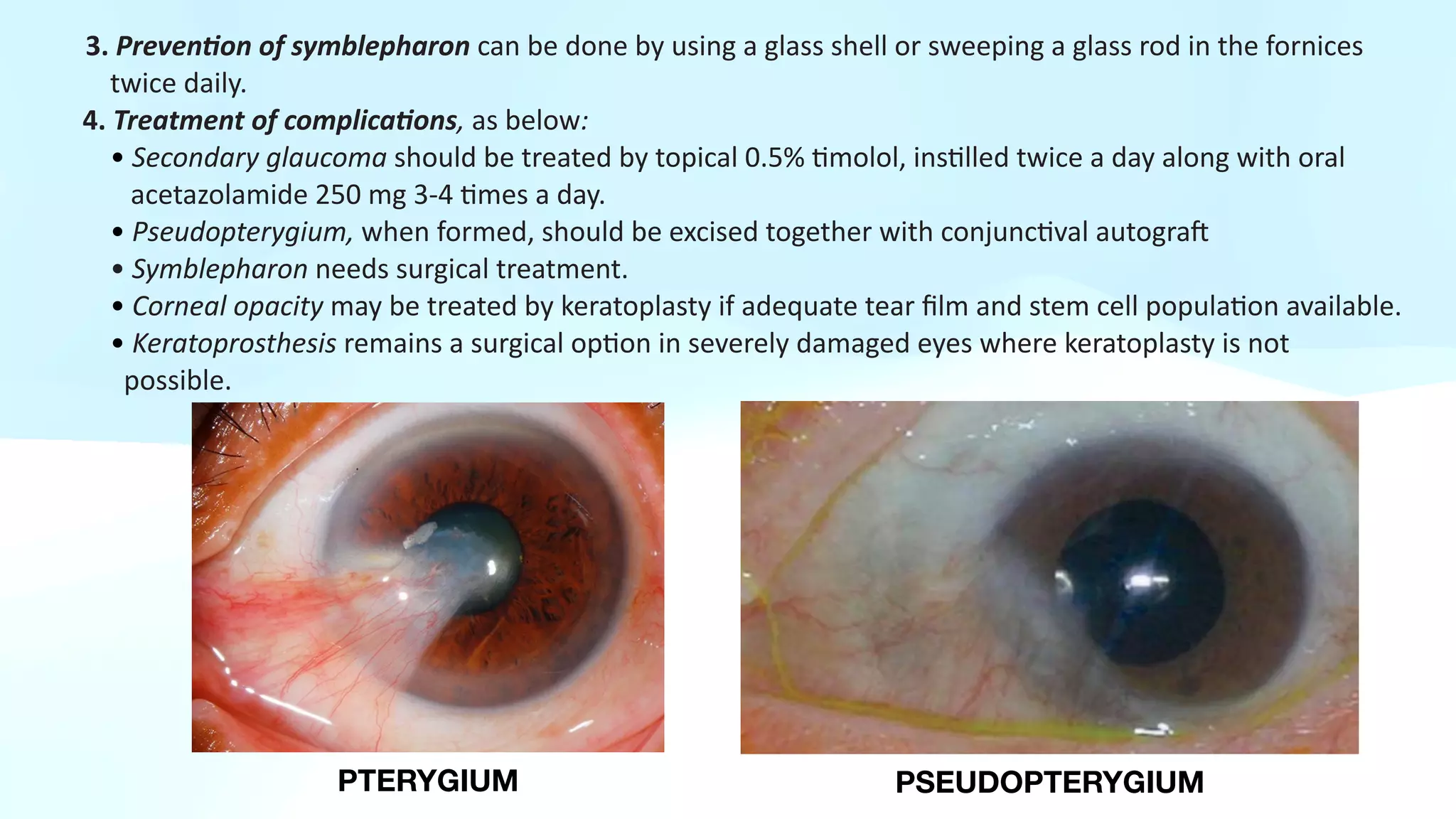 Cornial Shell OCULAR INJURIES | PDF