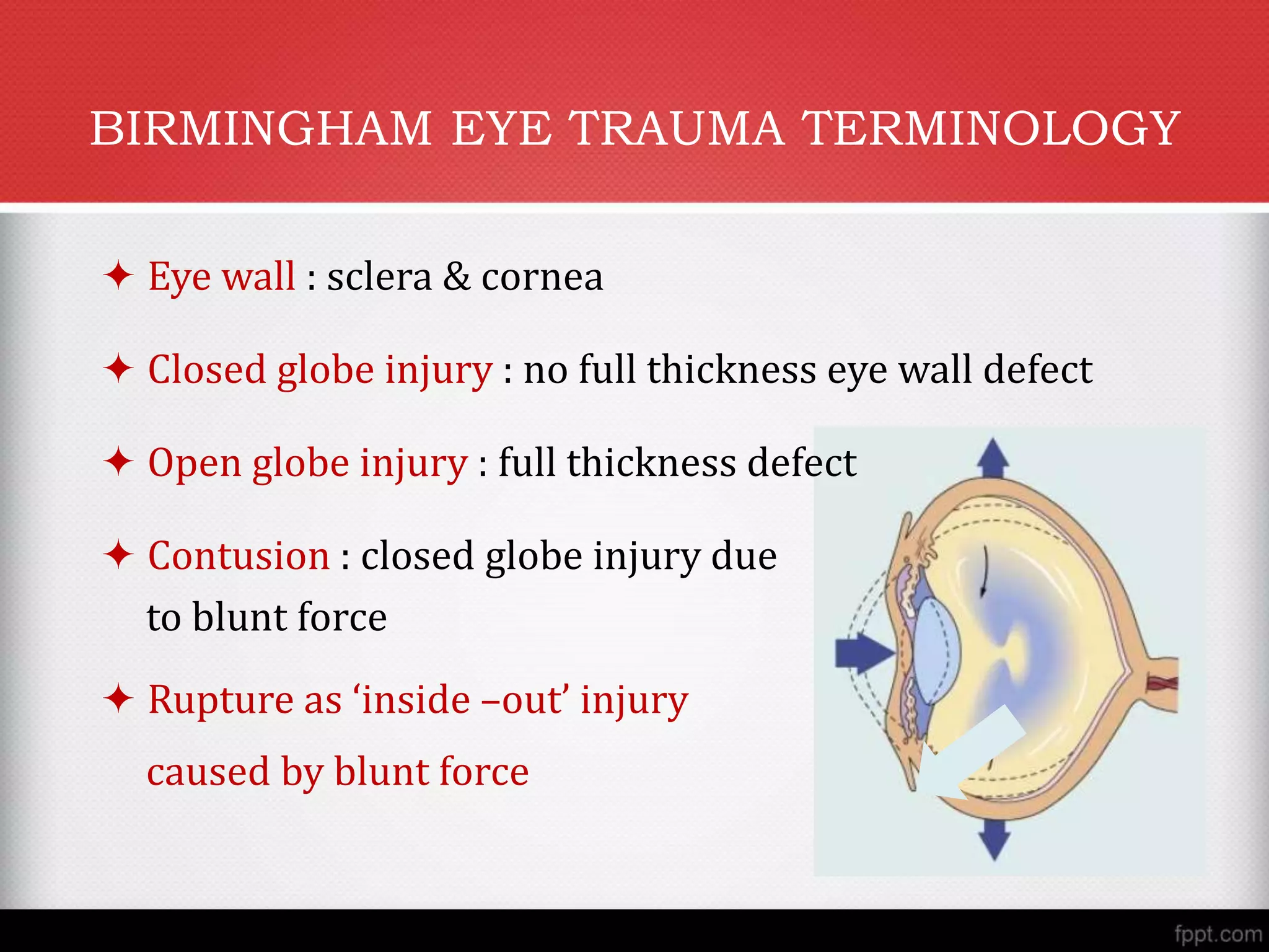 Ocular Injuries Classification Management Protocol pptx Ocular Injuries Classification Management Protocol pptx