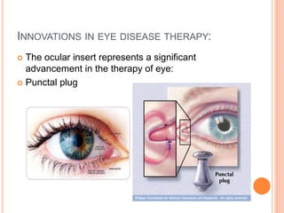 Ocular inserts | PPTX