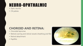 NEURO-OPHTHALMIC
• Optic neuritis
• CN palsies
CHOROID AND RETINA:
• Choroidal lepromas
• Retinal scarring and retinal vessels sheathing and fibrosis
• Retinal detachment
• Papillitis
 