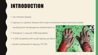INTRODUCTION
• a.k.a Hansen disease.
• Leprosy is a systemic disease with ocular involvement (most commonly uveitis)
resulting from hematogenous dissemination to the eye
• Prevalence: 1 case per 1000 population
• 5-10% of patients with ocular leprosy are blind
• Ocular involvement in leprosy: 70-75%
 