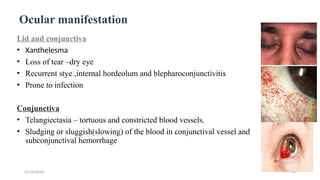 Ocular maifestation of DR by Bhuvan Nepal[2]-1.pptx
