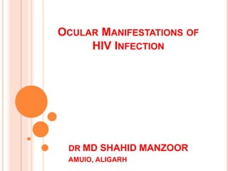 OCULAR MANIFESTATIONS OF
HIV INFECTION
DR MD SHAHID MANZOOR
AMUIO, ALIGARH
 