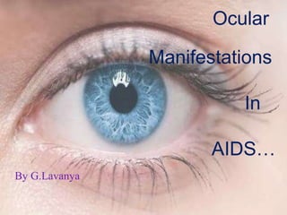 By G.Lavanya
Ocular
Manifestations
In
AIDS…
 