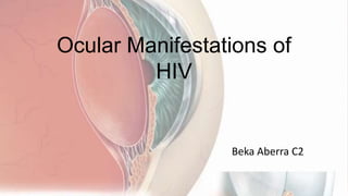 Ocular Manifestations of
         HIV


                 Beka Aberra C2
 