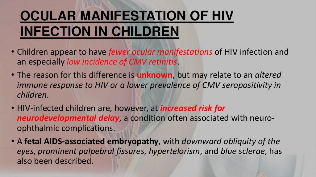 Ocular manifestations of hiv