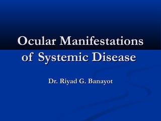 Ocular ManifestationsOcular Manifestations
of Systemic Diseaseof Systemic Disease
Dr. Riyad G. BanayotDr. Riyad G. Banayot
 