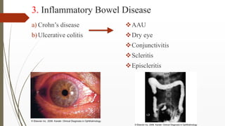 Ocular manifestations of systemic diseases | PPTX