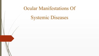 Ocular Manifestations Of
Systemic Diseases
 