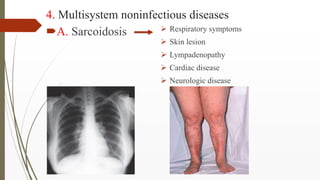 4. Multisystem noninfectious diseases
A. Sarcoidosis  Respiratory symptoms
 Skin lesion
 Lympadenopathy
 Cardiac dise...