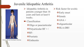 Juvenile Idiopathic Arthritis
 Idiopathic Arthritis in
patients younger than 16
years and lasts at least 6
weeks.
 Class...