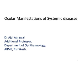 Ocular Manifestations of Systemic diseases
Dr Ajai Agrawal
Additional Professor,
Department of Ophthalmology,
AIIMS, Rishikesh.
1
 