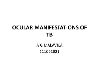 OCULAR MANIFESTATIONS OF
TB
A G MALAVIKA
111601021
 