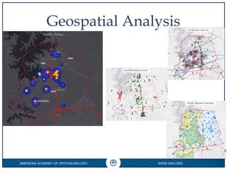 AMERICAN ACADEMY OF OPHTHALMOLOGY WWW.AAO.ORG
0
Geospatial Analysis
 