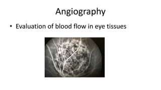 Angiography
• Evaluation of blood flow in eye tissues
 