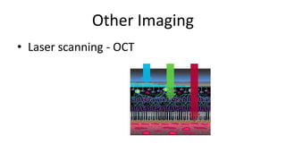 Other Imaging
• Laser scanning - OCT
 