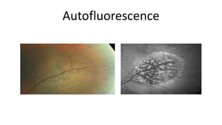 Autofluorescence
 