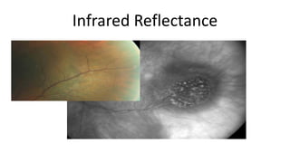 Infrared Reflectance
 