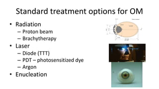 Standard treatment options for OM
• Radiation
– Proton beam
– Brachytherapy
• Laser
– Diode (TTT)
– PDT – photosensitized dye
– Argon
• Enucleation
 