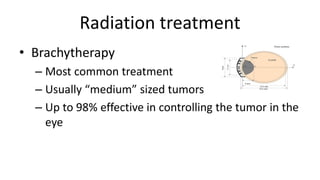 Radiation treatment
• Brachytherapy
– Most common treatment
– Usually “medium” sized tumors
– Up to 98% effective in controlling the tumor in the
eye
 