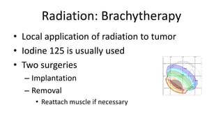 Radiation: Brachytherapy
• Local application of radiation to tumor
• Iodine 125 is usually used
• Two surgeries
– Implantation
– Removal
• Reattach muscle if necessary
 