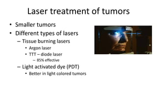 Laser treatment of tumors
• Smaller tumors
• Different types of lasers
– Tissue burning lasers
• Argon laser
• TTT – diode laser
– 85% effective
– Light activated dye (PDT)
• Better in light colored tumors
 
