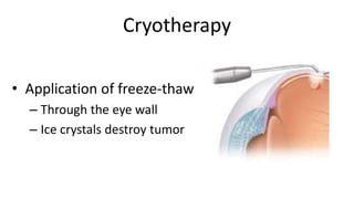 Cryotherapy
• Application of freeze-thaw
– Through the eye wall
– Ice crystals destroy tumor
 
