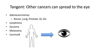 Tangent: Other cancers can spread to the eye
• Adenocarcinomas
– Breast, Lung, Prostate, GI, GU
• Lymphoma
• Sarcoma
• Melanoma
• Carcinoid
 