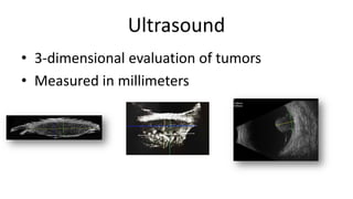 Ultrasound
• 3-dimensional evaluation of tumors
• Measured in millimeters
 