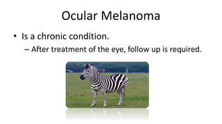 Ocular Melanoma Treatment