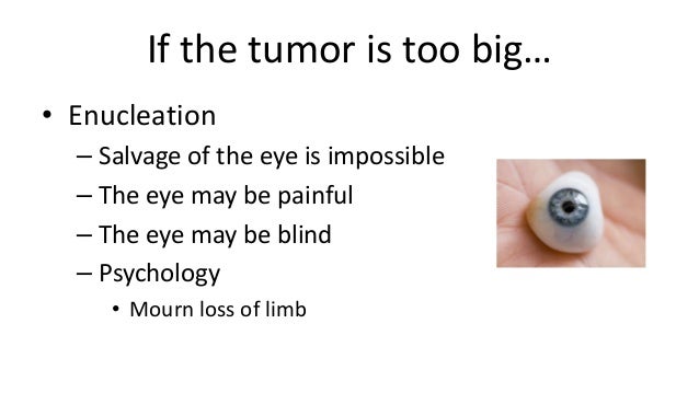Ocular Melanoma Treatment
