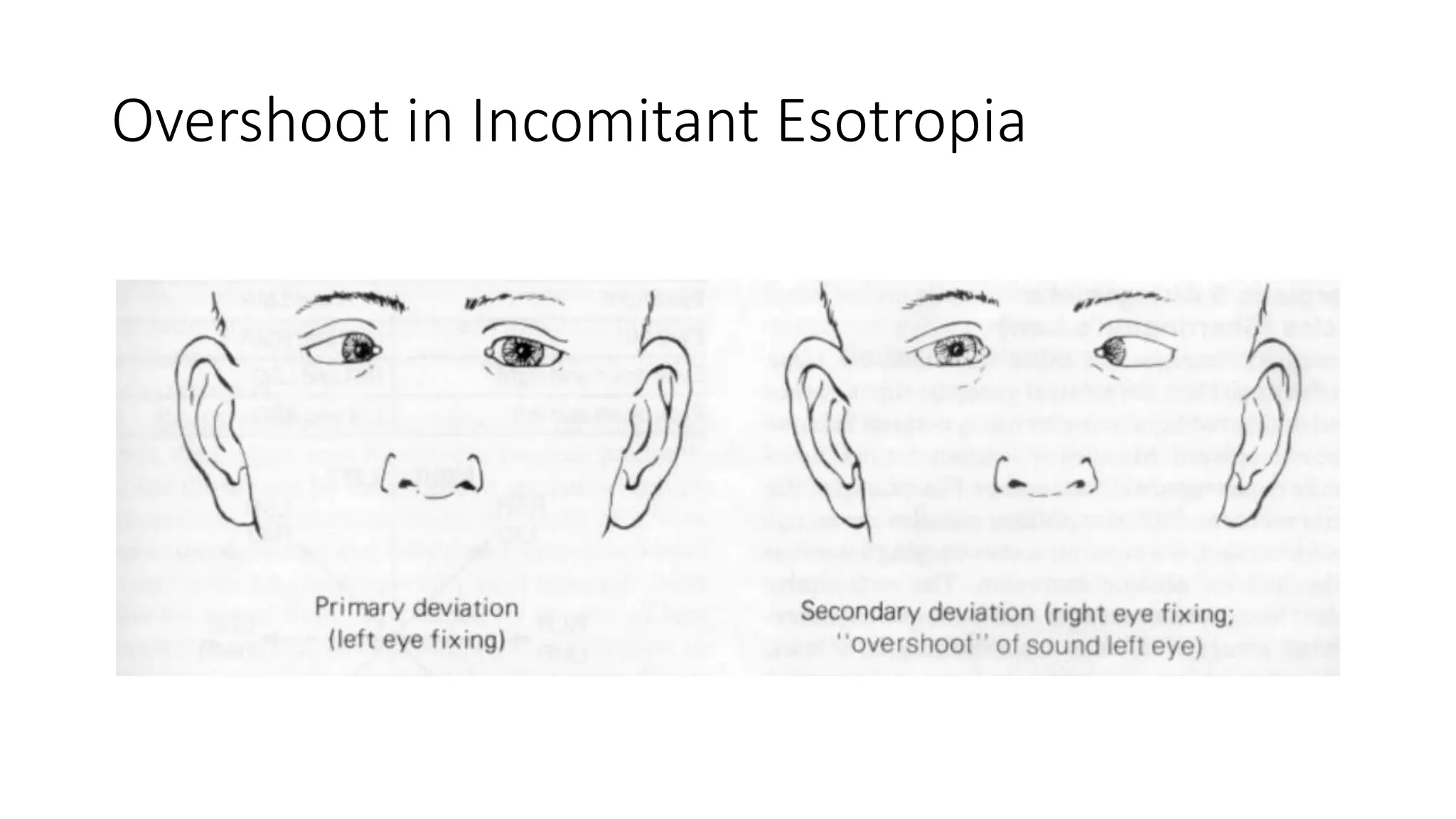 OCULAR MOTILITY.pptx