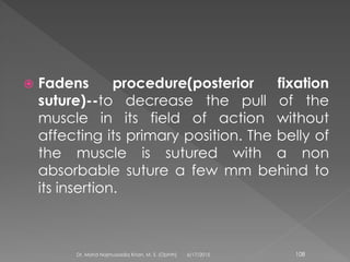  Fadens procedure(posterior fixation
suture)--to decrease the pull of the
muscle in its field of action without
affecting its primary position. The belly of
the muscle is sutured with a non
absorbable suture a few mm behind to
its insertion.
6/17/2015Dr. Mohd Najmussadiq Khan, M. S. (Ophth) 108
 