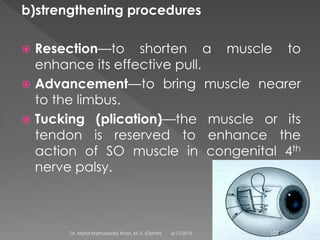 b)strengthening procedures
 Resection—to shorten a muscle to
enhance its effective pull.
 Advancement—to bring muscle nearer
to the limbus.
 Tucking (plication)—the muscle or its
tendon is reserved to enhance the
action of SO muscle in congenital 4th
nerve palsy.
6/17/2015Dr. Mohd Najmussadiq Khan, M. S. (Ophth) 109
 
