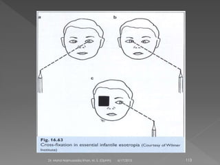 6/17/2015Dr. Mohd Najmussadiq Khan, M. S. (Ophth) 113
 