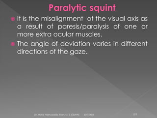  It is the misalignment of the visual axis as
a result of paresis/paralysis of one or
more extra ocular muscles.
 The angle of deviation varies in different
directions of the gaze.
6/17/2015Dr. Mohd Najmussadiq Khan, M. S. (Ophth) 119
 