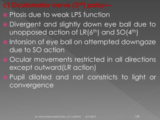 c) Oculomotor nerve (3rd) palsy—
 Ptosis due to weak LPS function
 Divergent and slightly down eye ball due to
unopposed action of LR(6th) and SO(4th)
 Intorsion of eye ball on attempted downgaze
due to SO action
 Ocular movements restricted in all directions
except outward(LR action)
 Pupil dilated and not constricts to light or
convergence
6/17/2015Dr. Mohd Najmussadiq Khan, M. S. (Ophth) 124
 