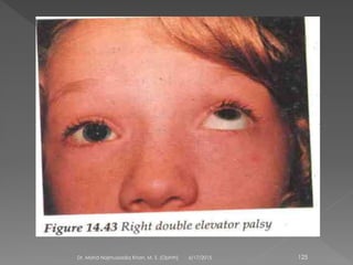 6/17/2015Dr. Mohd Najmussadiq Khan, M. S. (Ophth) 125
 