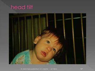 6/17/2015Dr. Mohd Najmussadiq Khan, M. S. (Ophth) 127
 