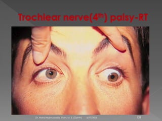 6/17/2015Dr. Mohd Najmussadiq Khan, M. S. (Ophth) 128
 